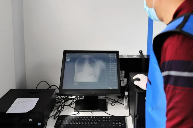 شبكة الحق في الصحة تدق ناقوس الخطر: السل يقتل 9 مغاربة يوميا